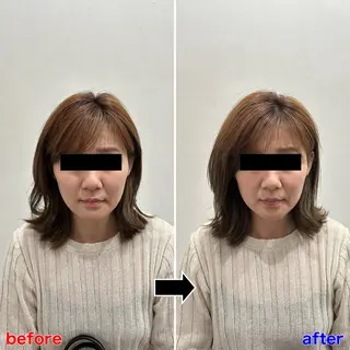 小顔矯正・美容鍼 FLOW鍼灸整体院のエステ・リラクイメージ