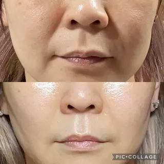 bianca【ビアンカ】所属・bianca 【菌活 温活 小顔】のエステ・リラクイメージ