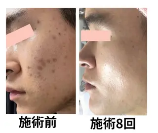 毛穴・ニキビ専門 エステグレースティーのエステ・リラクイメージ