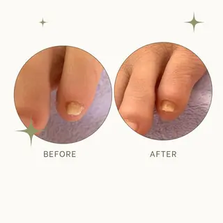 足トラブル専門 ニコルル金沢のエステ・リラクイメージ