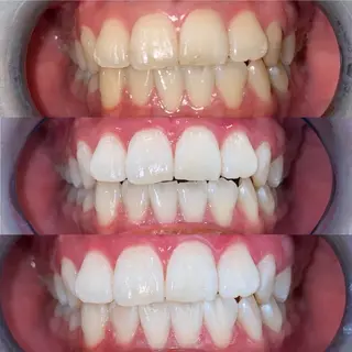 Whitening Beauty 行橋店のその他イメージ