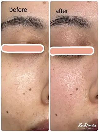 De I'm 名古屋栄店所属・原 いず美のエステ・リラクイメージ