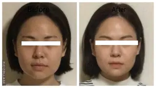 小顔矯正Sho  FaceDesignのエステ・リラクイメージ