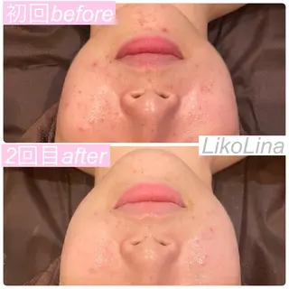 肌育脱毛サロン LikoLinaのその他イメージ