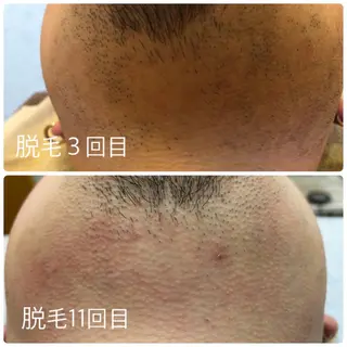 メンズ 人気🌻《髪質改善》 平井 綾乃のヘアスタイル