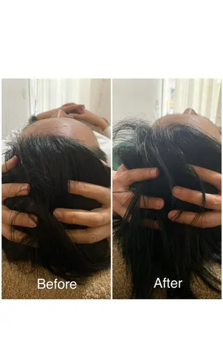 nina《快眠ドライヘッドスパ＆ボディーリンパケア》所属・nina 野沢あゆみのエステ・リラクイメージ