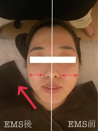 フェイシャル専門店　regalo所属・フェイシャル専門店 regaloのエステ・リラクイメージ