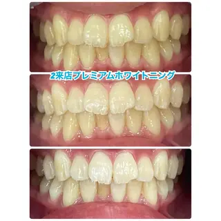 メンズ ネイル マツエク・マツパ アイブロウ 【歯科提携】柏ホワイ トニングスタイルのその他イメージ