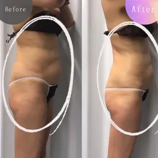 痩身・脱毛・肌管理 Rechica心斎橋のエステ・リラクイメージ