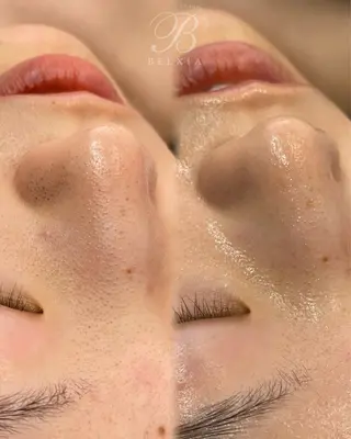 BELXIA所属・井櫻 玲香のエステ・リラクイメージ