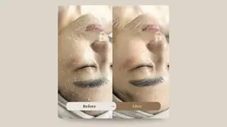 hue.所属・hue. YUKAのエステ・リラクイメージ