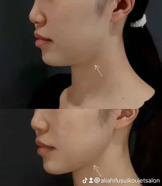 マツエク・マツパ aliaハイフ&水光ジェットサロン所属・aliaハーブ水光店 エステティシャン募集のエステ・リラクイメージ