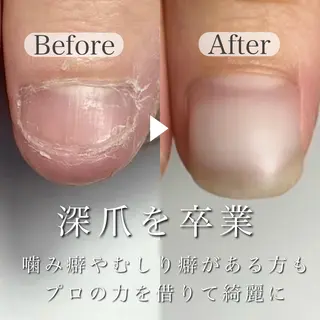 ネイル 深爪専門店 サロンリリーのネイルデザイン