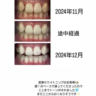 Kaula ホワイトニング🦷✨のエステ・リラクイメージ