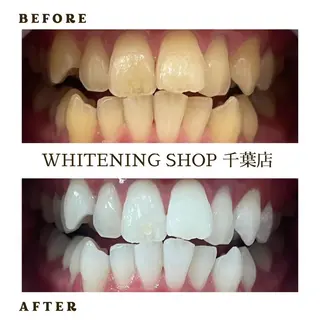 メンズ ホワイトニング ショップ千葉店のその他イメージ