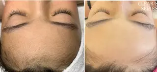 VANILLA SKYのエステ・リラクイメージ