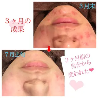 ミディアム カラー パーマ ヘアアレンジ メンズ キッズ ネイル マツエク・マツパ 金の糸脱毛 産毛ケア専門のエステ・リラクイメージ