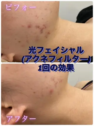 ショールームエステ becoのエステ・リラクイメージ