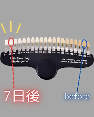 歯科提携セルフダック 宇都宮駒生店のエステ・リラクイメージ