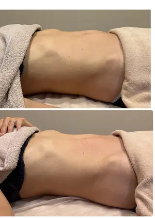 美肌脱毛サロン muroのエステ・リラクイメージ