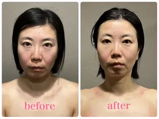 MIRAI小顔 栄店のエステ・リラクイメージ