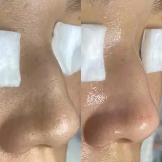 肌改善・リンパサロン CoCoxiaのエステ・リラクイメージ