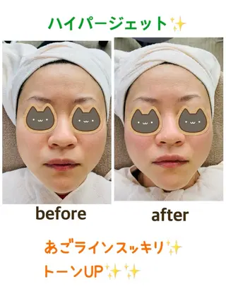 CHOUETTE所属・五島 久美子のエステ・リラクイメージ