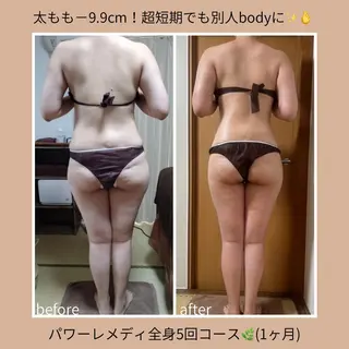 《本気痩せ×疲労改善 》  BILOOPのエステ・リラクイメージ