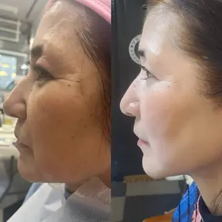 ラムーン アイラッシュ&ヘアメのマツエク・マツパデザイン