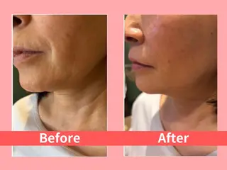 痩身&小顔矯正専門店 Re:Livesのエステ・リラクイメージ