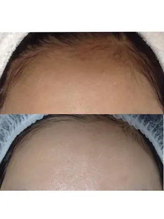 セミロング カラー パーマ ヘアアレンジ ネイル マツエク・マツパ 都度払い肌質改善 &脱毛Blancheのエステ・リラクイメージ