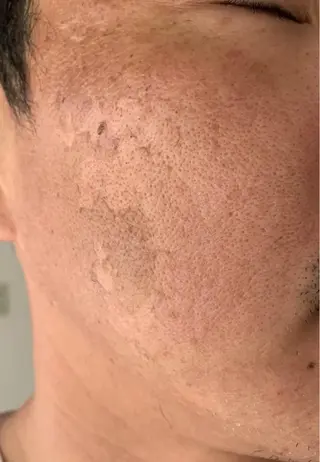 グランデ ルシアルのエステ・リラクイメージ