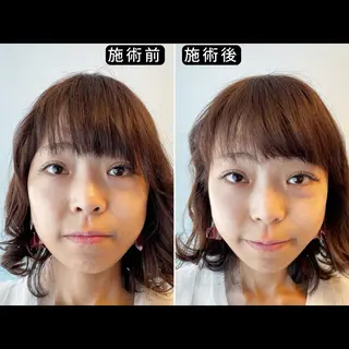 渋谷 小顔美容鍼 専門サロン YZのエステ・リラクイメージ