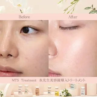 beauty salon Clochette所属・clochette misakoのエステ・リラクイメージ