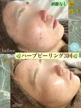 e-LABO こいずみのエステ・リラクイメージ