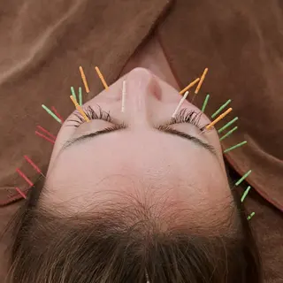 鍼灸サロンmiyabi所属・美容鍼×エステ　鍼灸 サロンmiyabiのエステ・リラクイメージ
