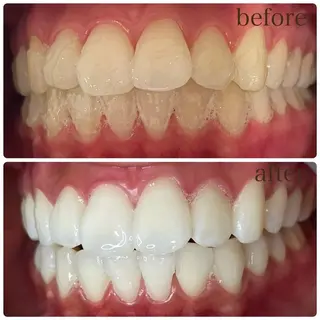 マツエク・マツパ アイブロウ LOVE ホワイトニング下北沢のエステ・リラクイメージ