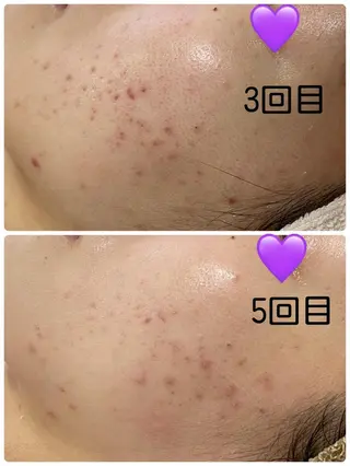 COCO beautyサロンのエステ・リラクイメージ