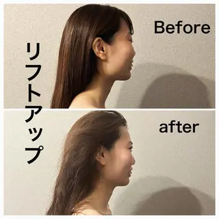 圧倒的たるみ改善 美容鍼エステのエステ・リラクイメージ