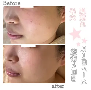 都度払い肌改善専門店 店長二上文香のエステ・リラクイメージ