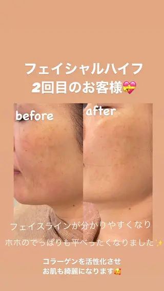 VERY VERY 九条店のエステ・リラクイメージ