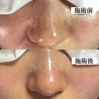 salon soso(ソソ)のエステ・リラクイメージ