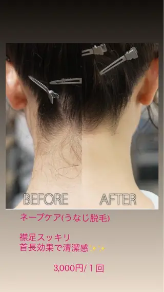 ネイル＆脱毛 Lotus🌸のネイルデザイン