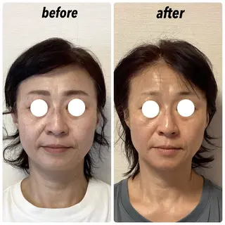 小顔・歪み専門　井元 朋子のエステ・リラクイメージ