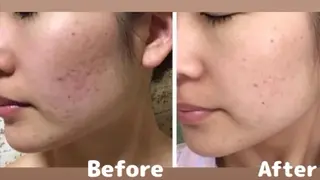 ANABEL+所属・肌の質を変えるエステ 🤍🫧Nanaのエステ・リラクイメージ