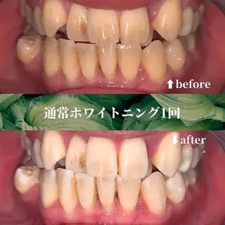 futaba ホワイトニング/天神のエステ・リラクイメージ