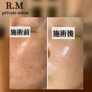 プライベートサロン R.Mのエステ・リラクイメージ