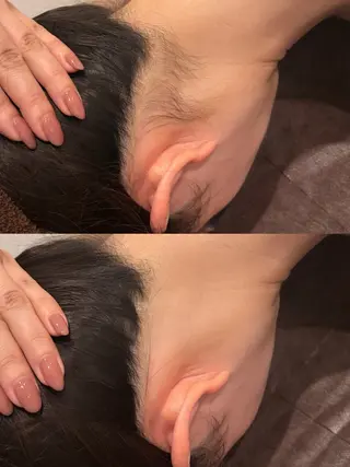脱毛サロン Exsior.博多店のエステ・リラクイメージ