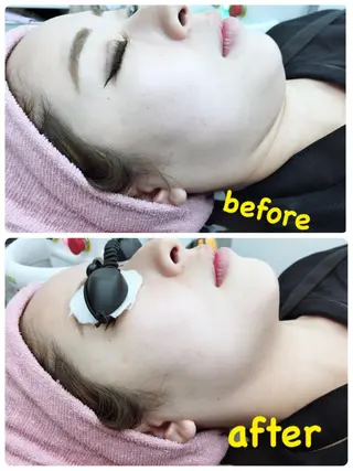 ハーブピーリングMB eautySalonのエステ・リラクイメージ