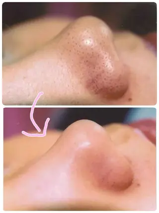 Non ビューティサロンのエステ・リラクイメージ